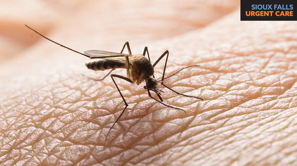 What’s the Buzz?
Everything You Need to Know About West Nile Virus